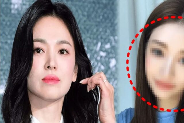“송혜교·전지현 아니었다”…’원정 성형’ 중국인이 가장 많이 들고오는 사진의 반전 정체