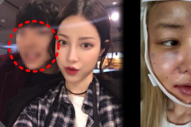 “눈 실핏줄 터질때까지 맞아”…유깻잎, 이혼 후 ‘남자친구’ 생기더니 성형한 진짜 이유