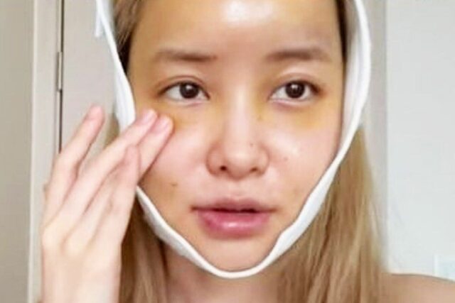 “진짜 누군지 못 알아보겠다” 또 얼굴에 손댔다는 방송인의 근황 모습