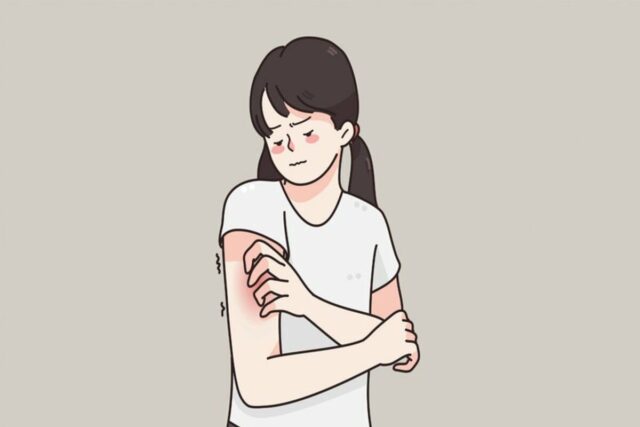[헬스S] ‘이 균’ 때문에 소아 아토피피부염 증상 악화
