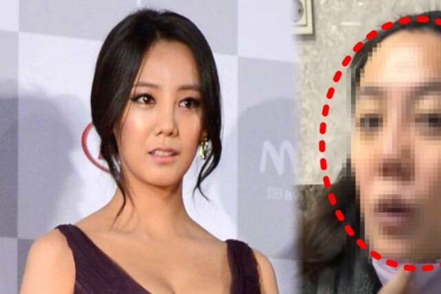 “코부터 입까지 찢어졌다”…성형한 고은아, 재수술 해야한다는 충격적인 현재 상태