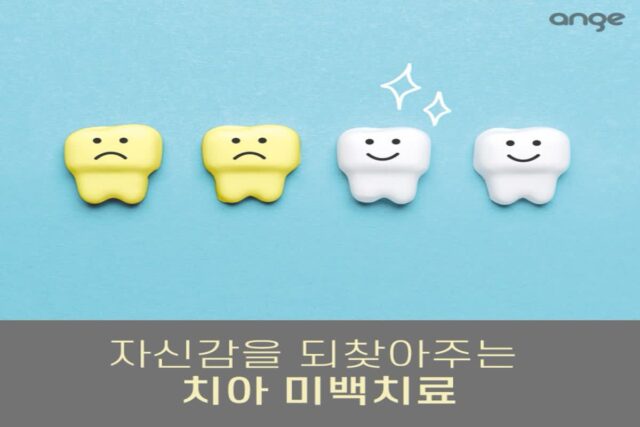 누렁니 탈출! 치아 미백치료 효과와 부작