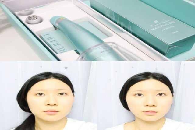 리쥬란 리쥬리프 뷰티디바이스 울마쥬 홈케어 후기