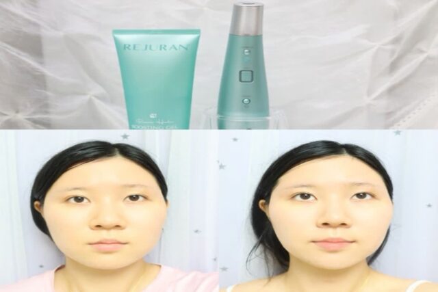 리쥬란 고주파마사지기 리쥬리프 뷰티디바이스 찐 후기!