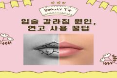 입술 갈라짐 원인과 연고 사용꿀팁