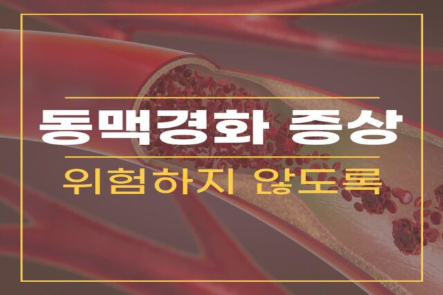 동맥경화 증상 원인 검사후 음식 동맥경화 치료 관리 방법은?
