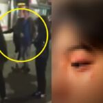 “흑인한테 맞았다” 유럽 가서 인종차별 당했다는 한국인이 겪은 일