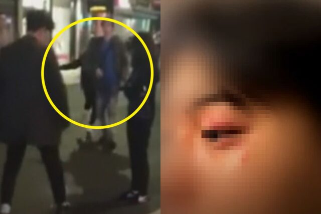 “흑인한테 맞았다” 유럽 가서 인종차별 당했다는 한국인이 겪은 일