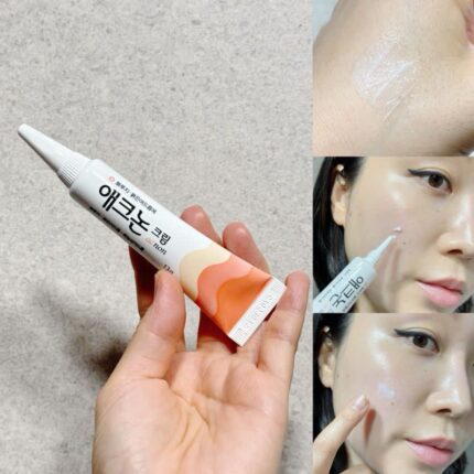 애크논 크림 약국가격 부작용 올바른 사용법 꿀팁까지
