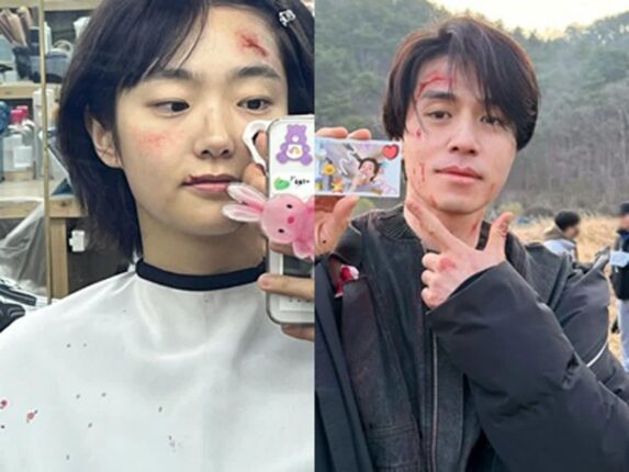 다치고 난리 났는데 최근 뜨거운 반응 얻고 있는 두 남녀