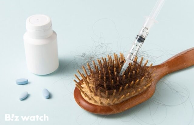 남성형 탈모, 20년 만에 신약 나올까…개발경쟁↑
