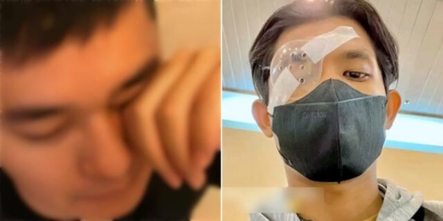 눈 간지러울 때마다 손으로 비볐다가 ‘각막이식’ 받게 된 21세 청년