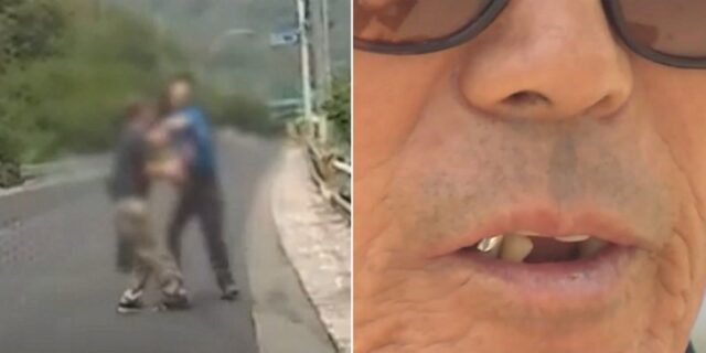 곡예운전 차량 막아선 시민, 폭행 당해 치아 3개 부러져…“운전자 무면허에 음주운전” (영상)