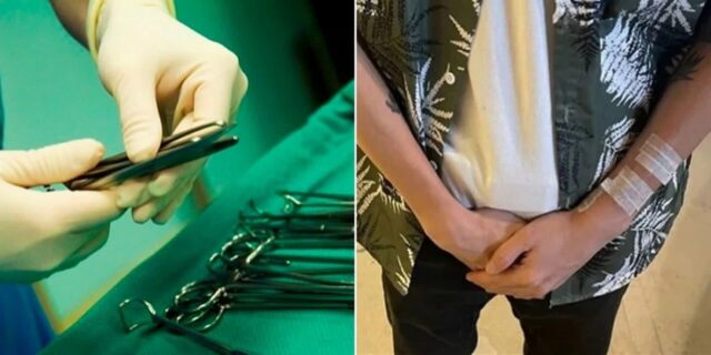 어릴 때 못 받은 ‘포경수술’ 유튜브 보고 집에서 셀프 시술한 남성의 최후