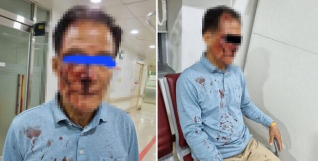“70대 택시기사 아버지가 승객한테 두들겨 맞아 얼굴에 피가 철철 났어요”
