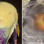땅콩인 줄 알고 씹었는데…배달시킨 아이스크림에서 발견된 ‘사람 손가락’