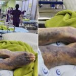 “간호사 실수로 시어머니 다리 부러졌는데, 요양원 이 사실을 ‘은폐’하려고 했습니다”