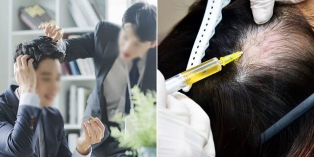 매일 ‘알약’ 안 먹고 1달에 한번 주사 맞으면 되는 ‘탈모 치료제’ 개발 중인 종근당