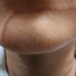 친구 손톱에 긁힌 아들 얼굴 상처 공개한 아빠…“친구끼리 그럴 수 있다 vs 그냥 넘어가선 안 돼”
