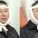 빚 청산 하더니…얼굴에 붕대 감고 퉁퉁 부은 채로 해맑게 웃으며 방송 출연한 이상민