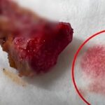 닭다리에서 핏물 뚝뚝 흐르는데…“먹어도 된다”는 유명 프랜차이즈 치킨 업체