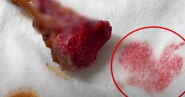 닭다리에서 핏물 뚝뚝 흐르는데…“먹어도 된다”는 유명 프랜차이즈 치킨 업체
