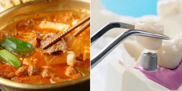 김치찌개서 ‘이빨’ 나왔다며 난리친 손님, 알고보니 본인 임플란트였다