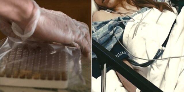 과민성대장증후군 때문에 ‘오빠 똥’ 이식받았다가 여드름까지 옮겨 받은 여동생