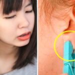 ‘빨래집게’ 하나로 단 5초 만에 ‘화요병’ 싹 사라지게 하는 꿀팁
