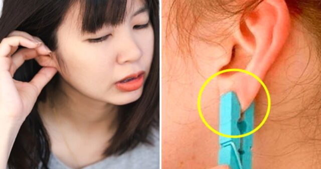 ‘빨래집게’ 하나로 단 5초 만에 ‘화요병’ 싹 사라지게 하는 꿀팁