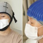 항암치료로 머리 빠지는 환우들 위해 탈모 막는 ‘기적의 모자’ 개발한 삼성서울병원 의료진들