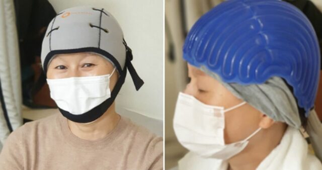 항암치료로 머리 빠지는 환우들 위해 탈모 막는 ‘기적의 모자’ 개발한 삼성서울병원 의료진들