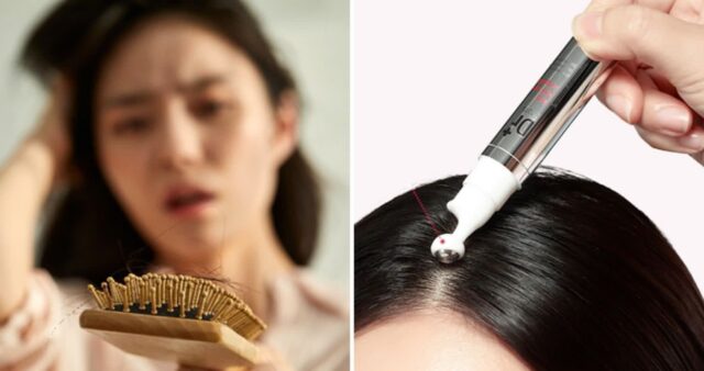 비싼 피부과 안 가고 집에서도 탈모 집중 케어할 수 있는 아이소이 탈모괄사앰플