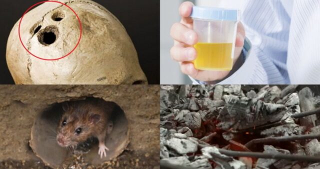 “진짜 이렇게 했다고?”…역사에 기록된 믿기 힘든 치료법 4가지