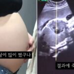 “제발 주작이기를”…36주 만삭 ‘임신중절수술’ 브이로그 영상 올린 20대 여성 논란