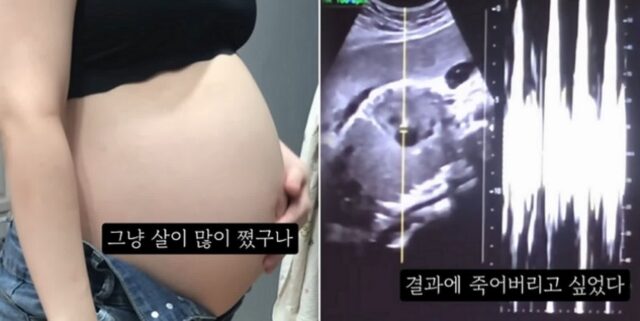 “제발 주작이기를”…36주 만삭 ‘임신중절수술’ 브이로그 영상 올린 20대 여성 논란