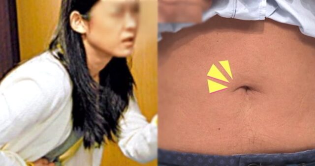 ‘배꼽’ 모양으로 확인하는 초간단 변비 자가진단법…“딱 3초만 투자하세요”