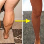 단단히 뭉친 ‘종아리 알’… 치약 짜듯 시원하게 없애줄 마법의 종아리 마사지 (영상)