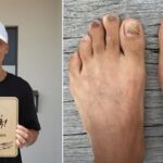 마라톤 뛰며 발톱 6개 빠진 션… 주변에서 말리는데도 5년째 81.5km 뛰는 이유