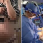 36주 태아 낙태 수술 논란에… 집도한 병원장 “뱃속에서 사산된 아이 꺼낸 것” 반박