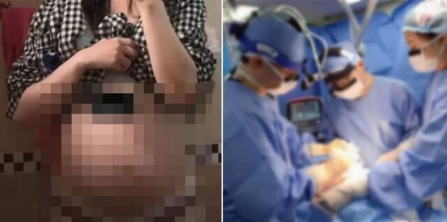 36주 태아 낙태 수술 논란에… 집도한 병원장 “뱃속에서 사산된 아이 꺼낸 것” 반박