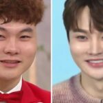 20대부터 성형 수술에 1억 투자… “프로그램 나올 때마다 매주 얼굴 달라져”