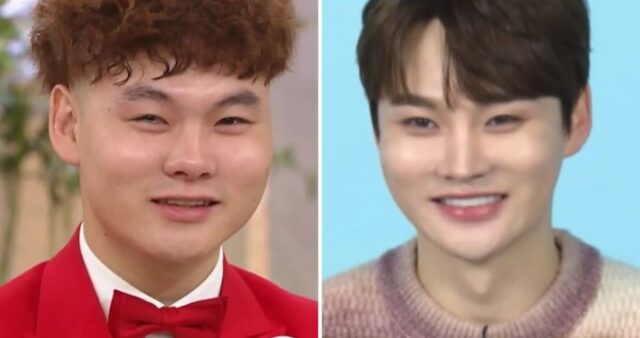 20대부터 성형 수술에 1억 투자… “프로그램 나올 때마다 매주 얼굴 달라져”