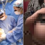 ‘36주 태아’ 낙태 수술한 병원장 “사산한 아이, 화장해”… 살인죄 입증 어려워져