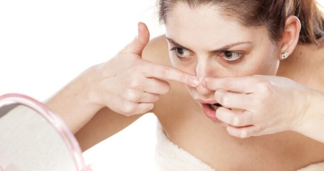 화장 뚫고 나오는 거뭇거뭇한 ‘블랙헤드’… 속 시원하게 제거하는 방법 7가지