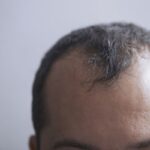 대머리는 ‘부자’될 확률 높아… 헤어라인으로 알아보는 7가지 성격 유형