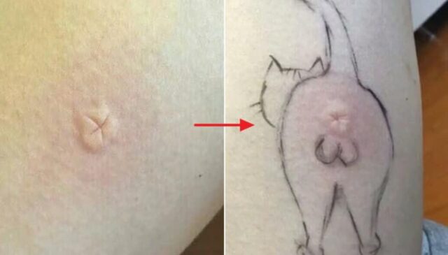 오빠한테 모기 물렸다고 잡아달라고 부탁했다가 잠시후 뜻밖의 장난에 웃음 터진 이유