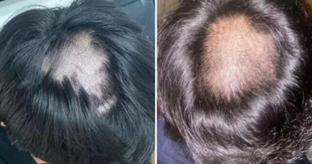 두발 규정 어겼다고 바리깡으로 남학생들 ‘정수리’만 싹 다 밀어버린 교사 (영상)