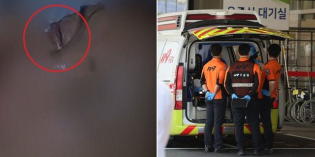 순간접착제 ‘안약’으로 착각해 눈에 넣은 40대 女… 20개 병원 응급실서 이송 거부