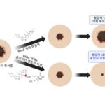 KIST, 새 흑색종 항암제 개발 전략 제시…	“내성 발성 억제”